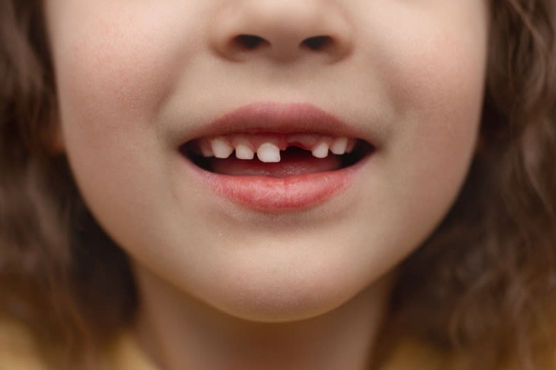 For 20 Years, She Was the Silent Tooth Fairy