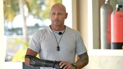 A shark took my limbs — I’d never trade them