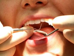 NHS dental system reforms unveiled to fix broken care