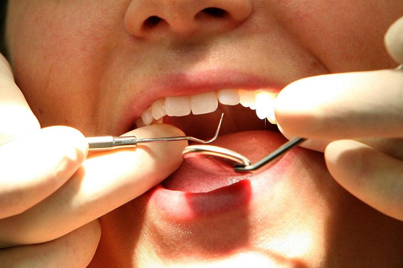 NHS dental system reforms unveiled to fix broken care