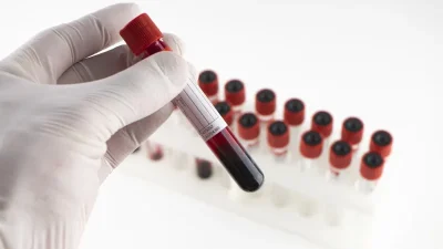 Kauvery Hospital Introduces CAR-T Cell Therapy for Blood Cancers