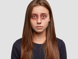 Mengapa Mata Sakit Bisa Menular? Ini Fakta Sebenarnya! Mengapa Mata Sakit Bisa Menular? Ini Fakta Sebenarnya!