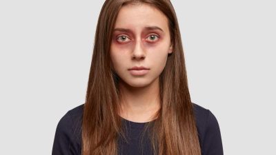 Mengapa Mata Sakit Bisa Menular? Ini Fakta Sebenarnya!