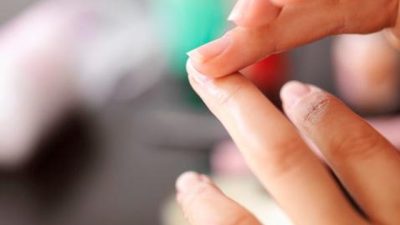 5 Tanda Kolesterol Tinggi di Kuku, Cek Sekarang!