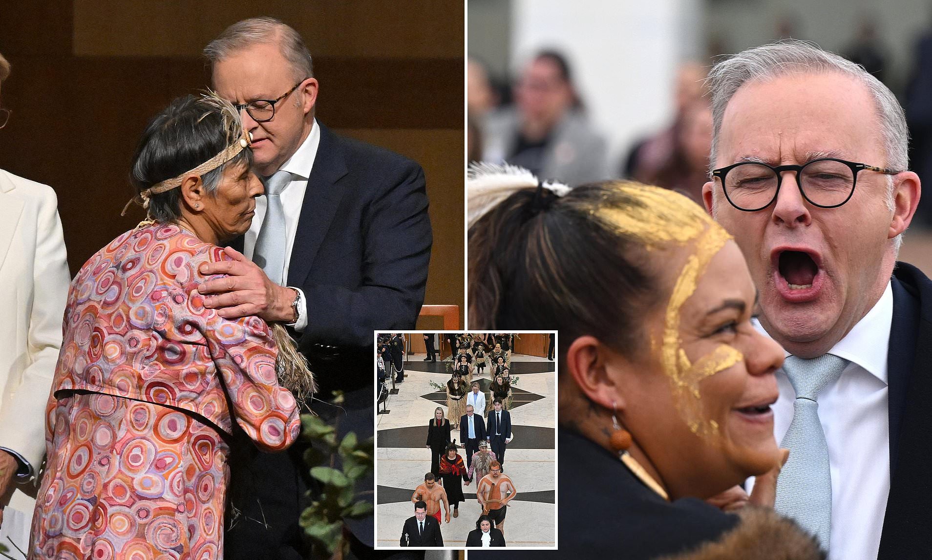 Anthony Albanese’s Response to Critics of Welcome To Country