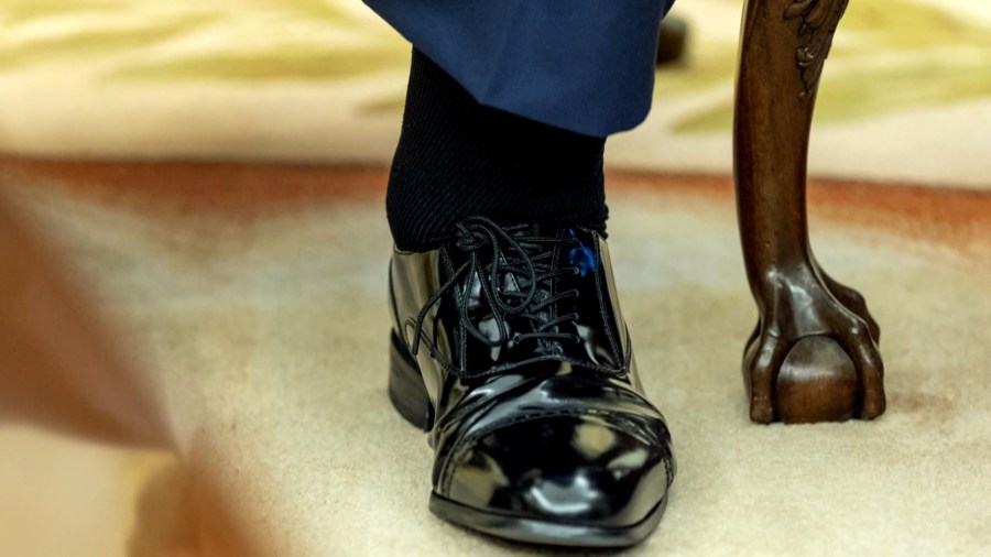 Trump’s Swollen Ankles Linked to Vein Issue
