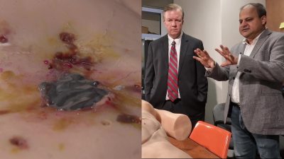 UCF Chemists Create Life-Saving Wound Sealant