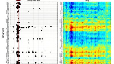 Facial Muscle Stimulation Reveals Emotional Perception Insights