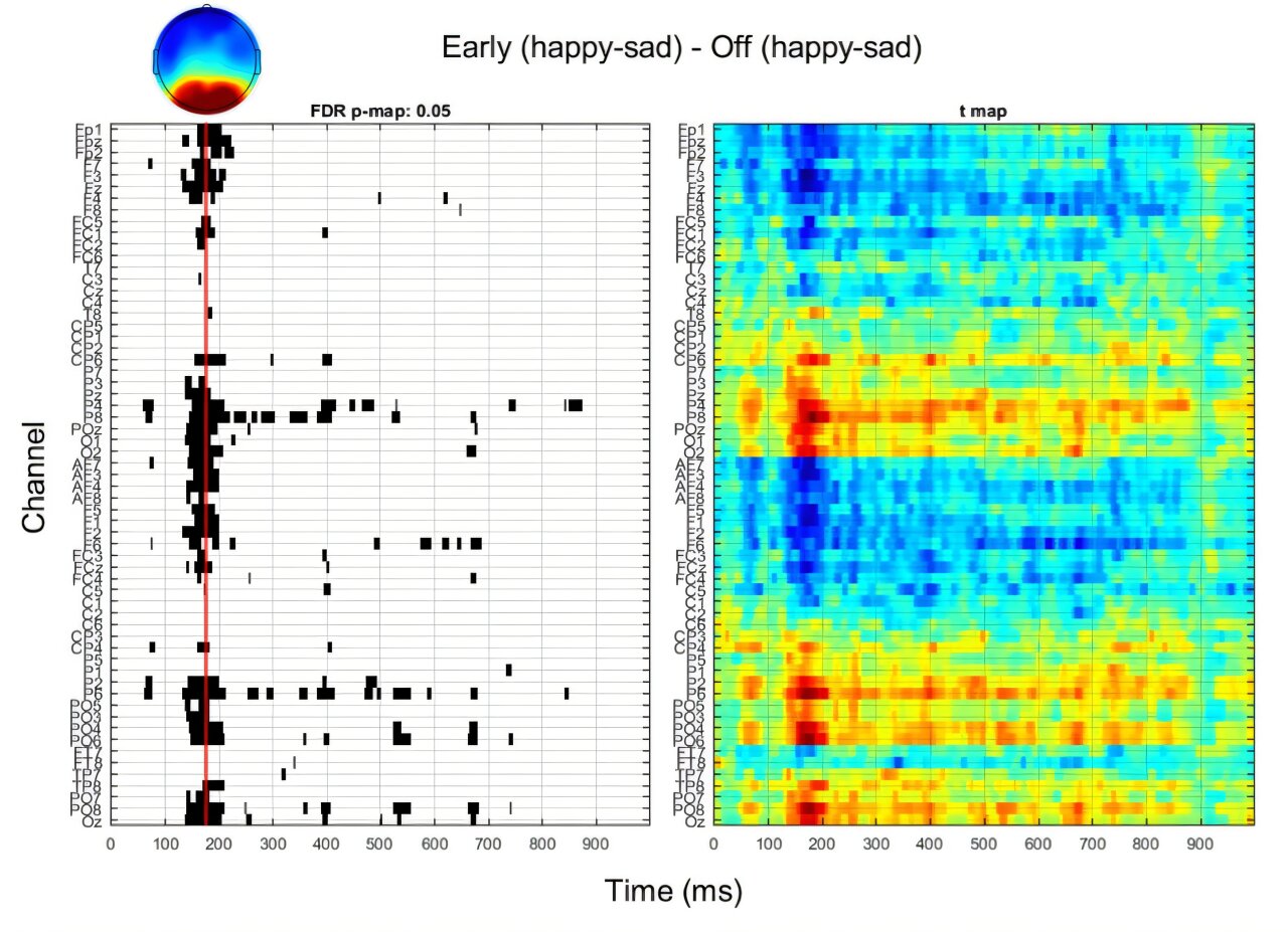 Facial Muscle Stimulation Reveals Emotional Perception Insights