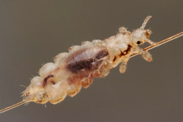 So THAT’s the Difference Between Nits and Head Lice