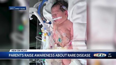 Parents Share Daughter’s Rare Genetic Struggle to Raise Awareness