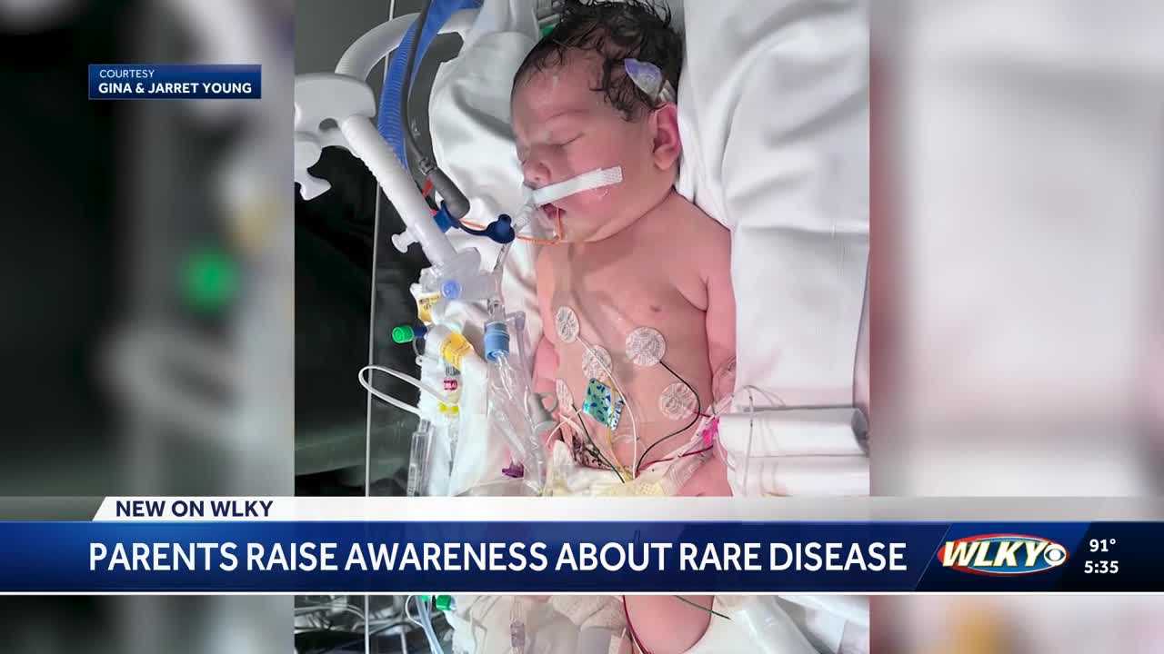 Parents Share Daughter’s Rare Genetic Struggle to Raise Awareness