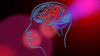 Kenali Risiko Stroke dengan Pemeriksaan Transcranial Doppler