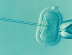 Why three-person embryos are a scientific breakthrough, but not for LGBTQ+ families
