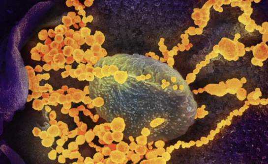 CDC: COVID-19 Cases Surge in Parts of the U.S.