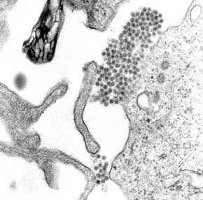 Dengue Outbreak Escalates in Khulna as Hospitals Struggle