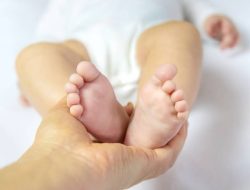 Bukan Hanya Genetik, Ini Penyebab Kaki Pengkor pada Bayi Baru Lahir