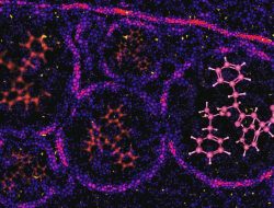 Nanotech Revolutionizes Early Cancer Detection Nanotech Revolutionizes Early Cancer Detection