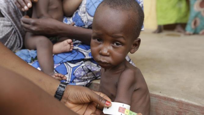 11 Million Nigerian Children Under 5 Suffering From Food Poverty – UNICEF