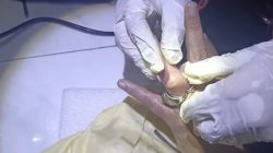 Jari Bengkak Akibat Gigitan Serangga, Petugas Pemadam Bantu Lepaskan Cincin