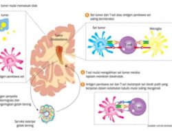 Sejarah Penyakit Bintang The Walking Dead: Jenis Glioma