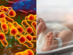 Warning: Millions Lured by Spread Linked to Deadly Botulism