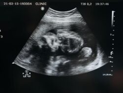Kapan Jenis Kelamin Bayi Diketahui?