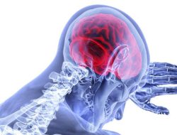 Kelley Mack dan Riwayat Glioma: Mengenali Tumor Otak