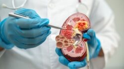 Makanan dan Minuman Bisa Sebabkan Gagal Ginjal Akut pada Anak? Ini Penjelasan Dokter