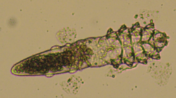 Demodex Folliculorum, Tungau di Wajah