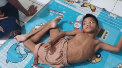 Meliuk Menahan Nyeri, Hadijah Ditinggalkan Ibu Karena Sakit